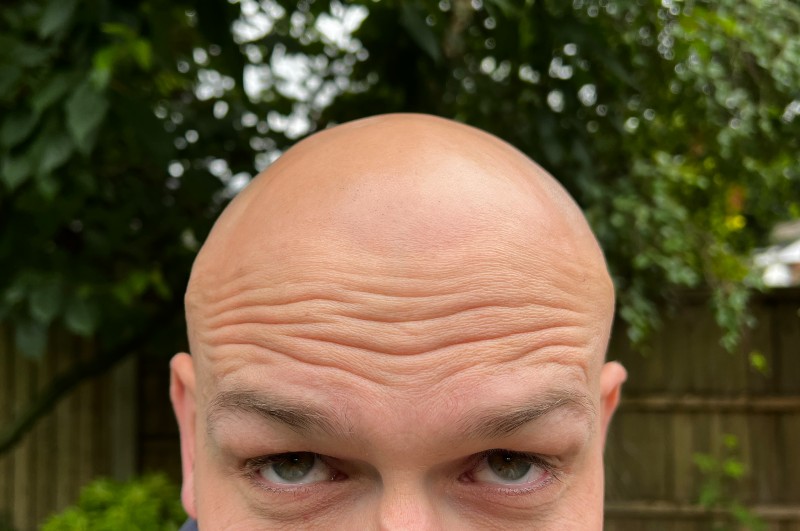 bald head