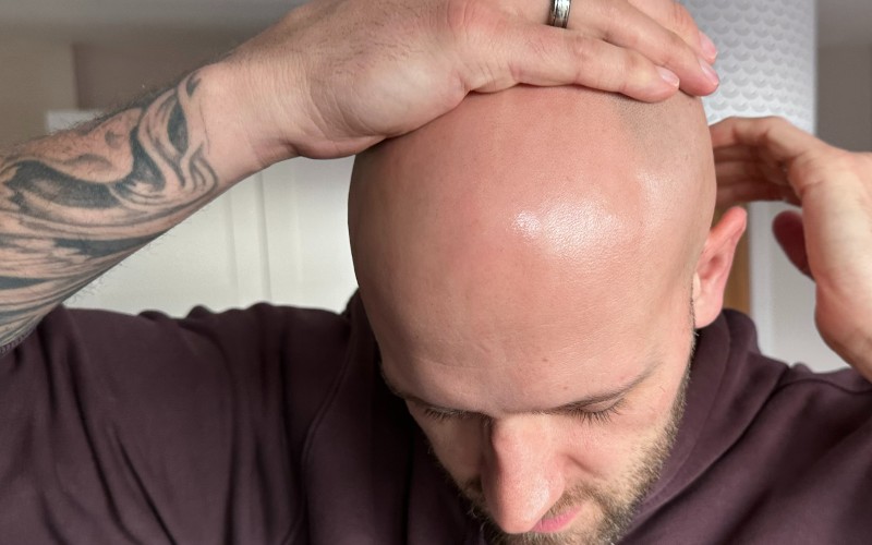 Bald man checking head shape