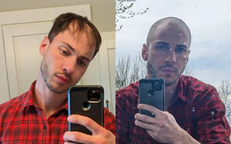 Shaved head - before and after