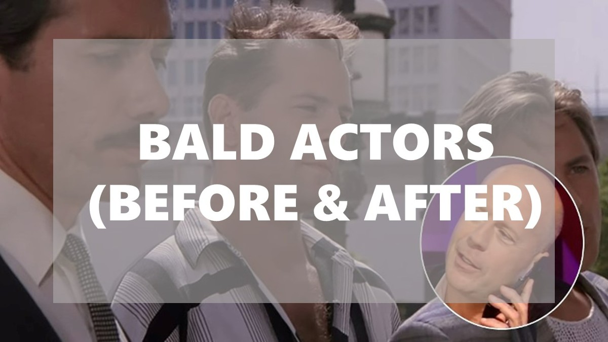 bald actors