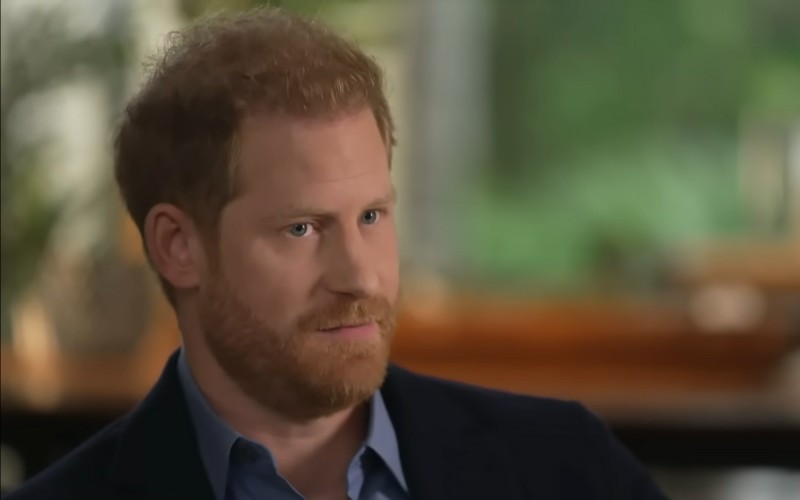 Prince Harry with thinning hair